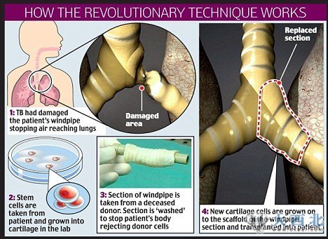 对患者克劳迪娅的手术详解 对患者克劳迪娅的手术详解