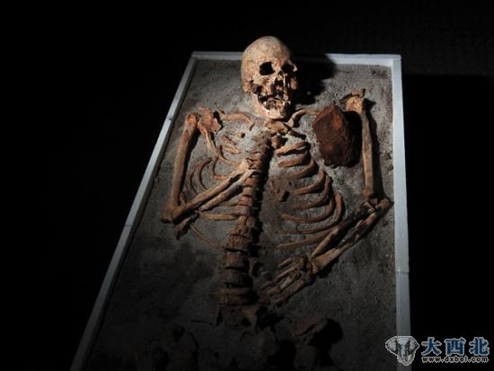 拔光所有牙齿 拔光所有牙齿