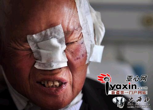 新疆富蕴饿狼夜袭村庄咬伤5人 当地成立临时捕杀小组 新疆富蕴饿狼夜袭村庄咬伤5人 当地成立临时捕杀小组