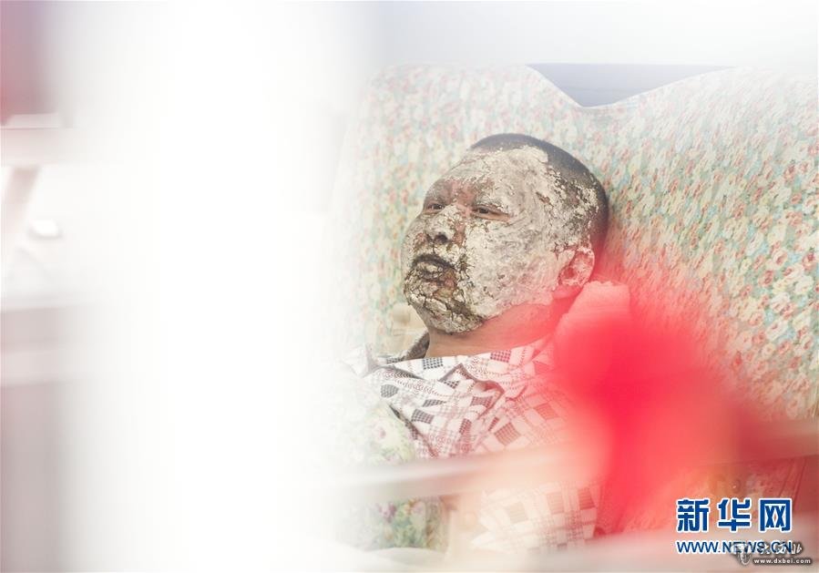 (中国网事·感动人物·图文互动)(2)“炸弹”引爆瞬间,他用胸膛堵了上去——湖北“扑爆哥”为救人用身体压住“炸弹”